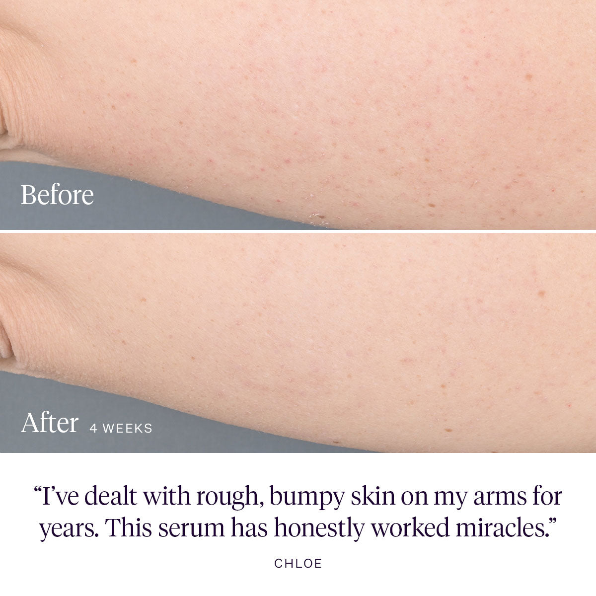 Kaleidoscope Body Serum Before and After