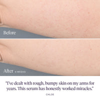 Kaleidoscope Body Serum Before and After