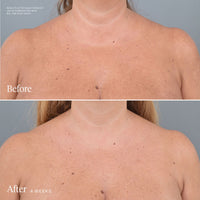 Mini Future Romance Body Glaze Before and After 2